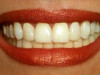 Eksperte: zobu saslimšana var izraisīt arī citas organisma problēmas